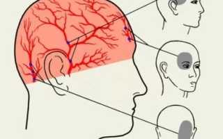 Болит голова в области затылка и шеи что это