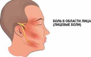 Болит правая сторона лица и головы что это