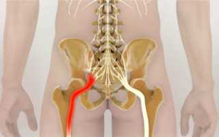 От чего болит низ спины у женщин больно ходить