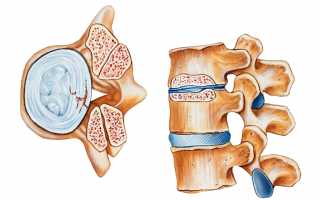 Болит шея при откидывании головы назад