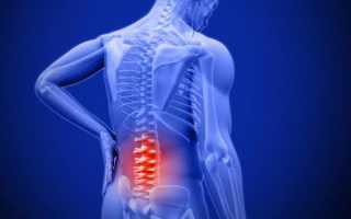 Если болит спина и отдает в правую ногу