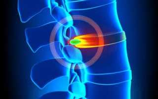 Болит и кружится голова болит шея и между лопатками