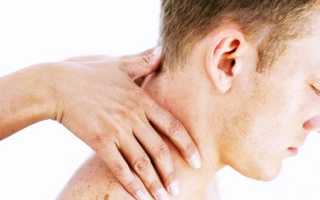 Что сделать если болит голова каждые дни