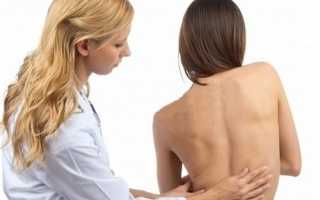 Может ли при менопаузе болеть спина