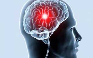 Что такое когда постоянно болит голова