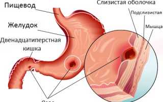 Может болеть спина но отдавать в живот