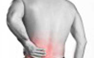 Как долго болит спина от прострела в