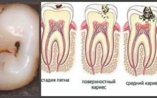 От зуба может болеть глаз и голова