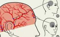 Что означает если болит голова и глаза
