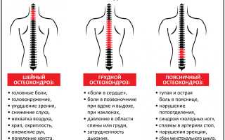 Что является причиной болей в спине