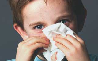 Болит голова высмаркиваюсь с кровью