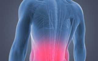 Нужно ли делать упражнения если болит спина