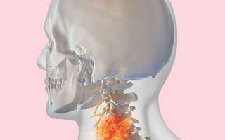 Упражнения если болит шея и голова