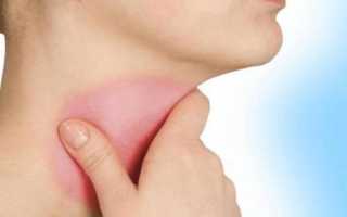 Несколько дней болит голова и горло