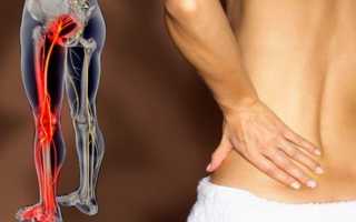 Болит нога и отдает в спину что это