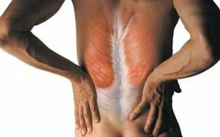 Что делать если потянул спину и болит под лопаткой