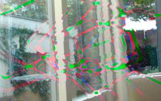 Аура перед глазами и не болит голова