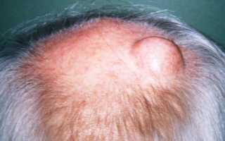 Шишка на голове болит это опасно