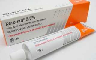 Болит шея и голова какие мази