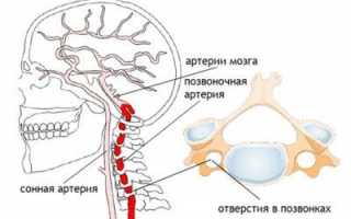 Как болит голова при шейном
