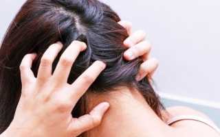 Голова тяжелая болит мурашки