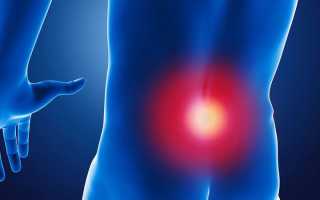 Болит спина как будто защемило