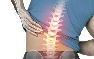 Болит спина долго стою хожу не болит
