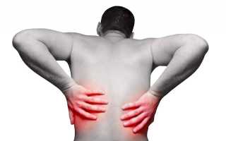 Болит спина выше поясницы как лечить