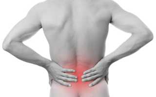Болит спина в области таза отдает в ногу