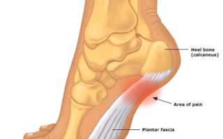 Болит спина отдает в пятку
