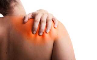 Упал на спину болит лопатка