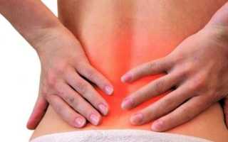 Если сильно болит спина в пояснице