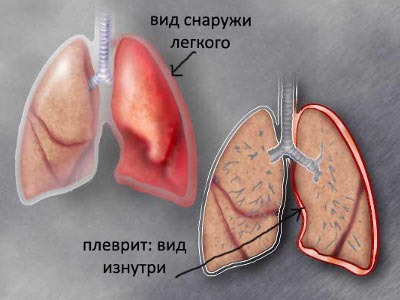 болит правый бок и тянет спину что это может быть