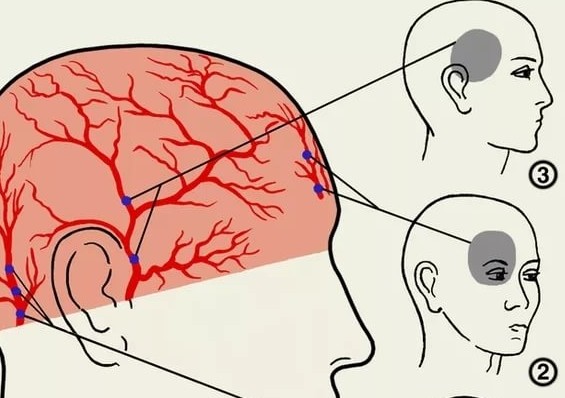 Что означает если болит голова и глаза