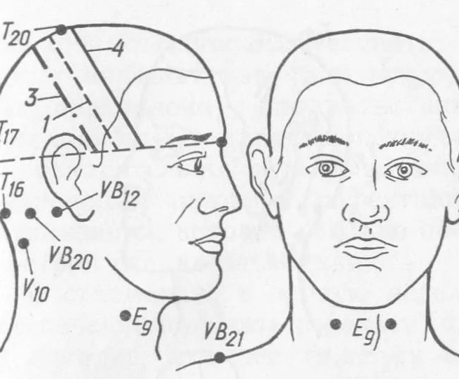 Болит голова и давит на глаза