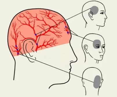 Болит голова в области затылка и шеи что это