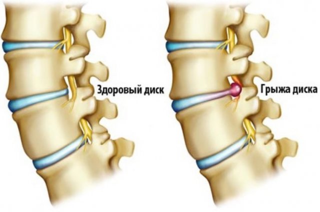 При наклоне головы болит спина и при дыхании