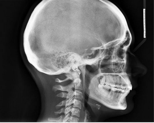 Когда встаешь очень болит голова