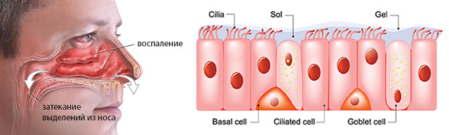 Болит голова высмаркиваюсь с кровью