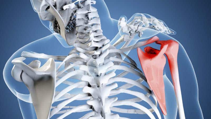 Как лечить ушиб лопатки