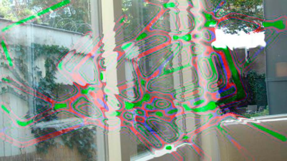 Аура перед глазами и не болит голова