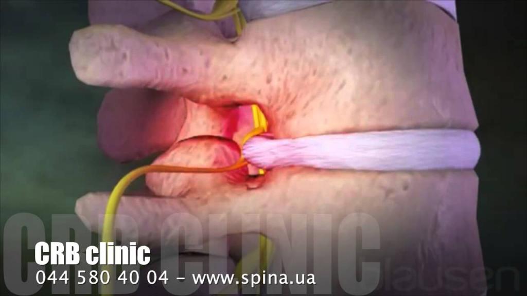 Болит спина внизу причины болей