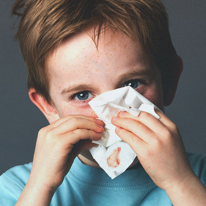 Болит голова высмаркиваюсь с кровью