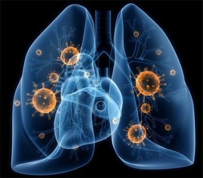 болит правый бок и тянет спину что это может быть