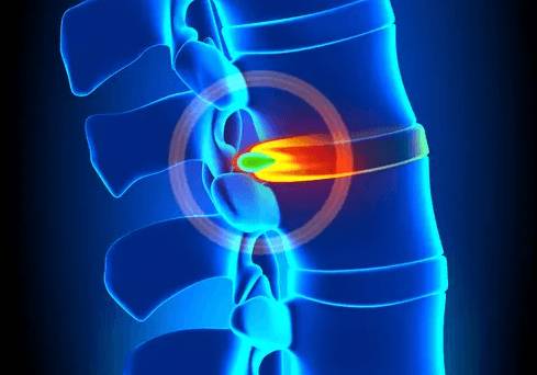 Болит спина между лопаток и затылок