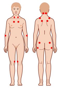 Заболевания сердца от которого болит спина