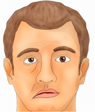 От чего сильно болит голова при движении