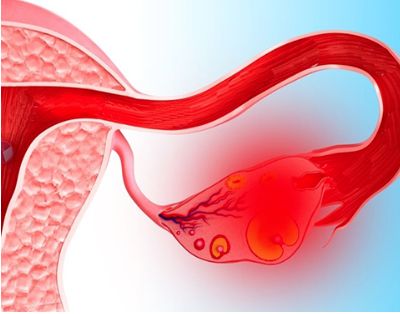 У меня болит спина после месячных