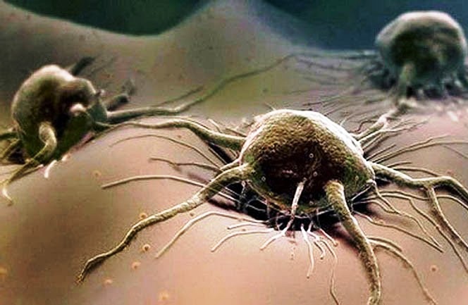 Трихомониаз - что это за заболевание