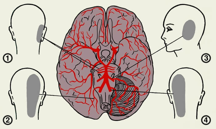 Что означает головная боль в затылочной части головы Что означает головная боль в затылочной части головы